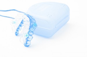 マウスピース マウスピース