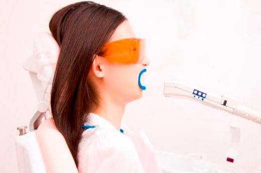 ホワイトニングをする女性